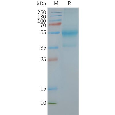 page-FLP100074 CXCR4 Fig.2 SDS PAGE 1