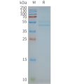 page-FLP100075 CCR3 Fig.2 SDS PAGE 1