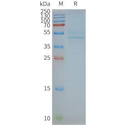 page-FLP100075 CCR3 Fig.2 SDS PAGE 1