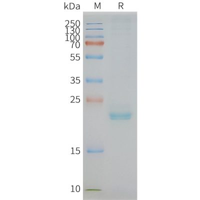 page-FLP100078 CLDN3 Fig.2 SDS PAGE 1