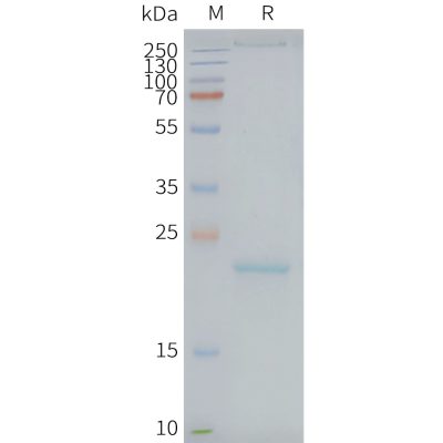 page-FLP100081 CLDN9 Fig.2 SDS PAGE 1