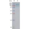 page-FLP100084 SLC2A12 Fig.2 SDS PAGE 1