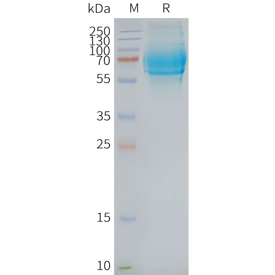 FLP100085-GCGR-Fig.2-SDS-PAGE-1.jpg