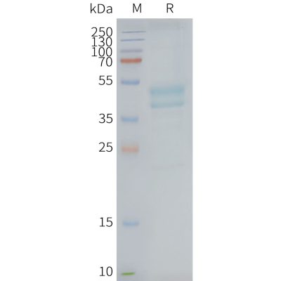 page-FLP100086 C5AR1 Fig.2 SDS PAGE 1