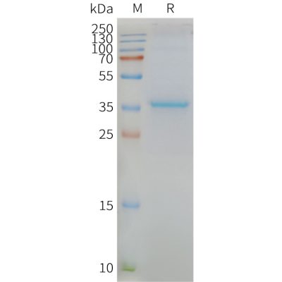 page-FLP100087 MLC1 Fig.2 SDS PAGE 1