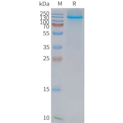 page-FLP100089 NPC1L1 Fig.2 SDS PAGE 1