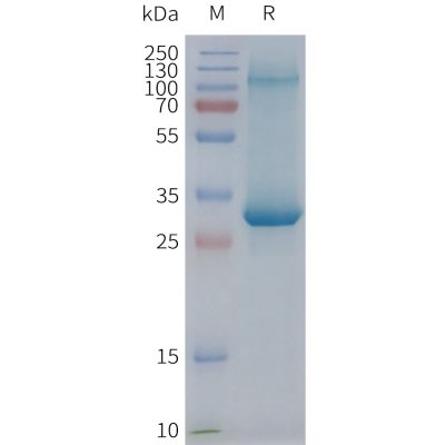 page-FLP100090 ADGRE2 Fig.2 SDS PAGE 1