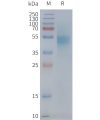 page-FLP100091 CXCR1 Fig.2 SDS PAGE 1