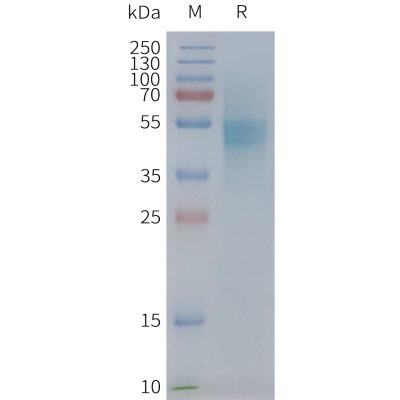 page-FLP100091 CXCR1 Fig.2 SDS PAGE 1