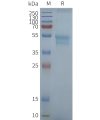 page-FLP100094 CCR1 Fig.2 SDS PAGE 1