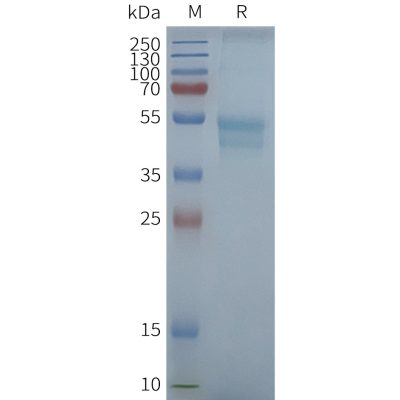 page-FLP100094 CCR1 Fig.2 SDS PAGE 1