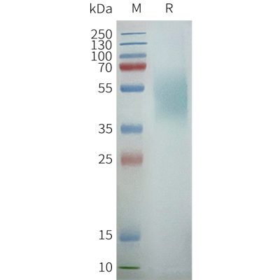 page-FLP100095 CXCR7 Fig.2 SDS PAGE 1