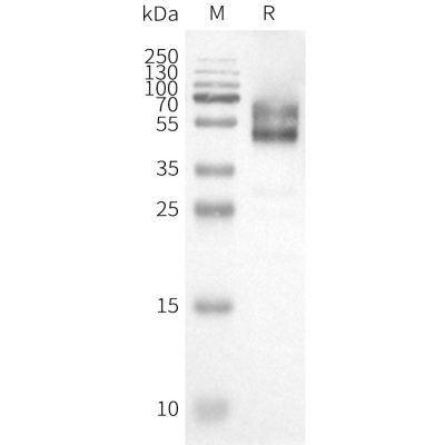 page-FLP100099 HCRTR1 Fig.2 SDS PAGE 1