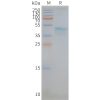 page-FLP100100 CCR5 Fig.2 SDS PAGE 1