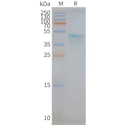 page-FLP100100 CCR5 Fig.2 SDS PAGE 1