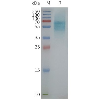 page-FLP100102 PROKR1 Fig.2 SDS PAGE 1