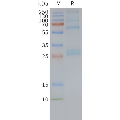 page-FLP100104 ADGRG1 Fig.2 SDS PAGE 1