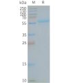 page-FLP100106 MFSD13A Fig.2 SDS PAGE 1