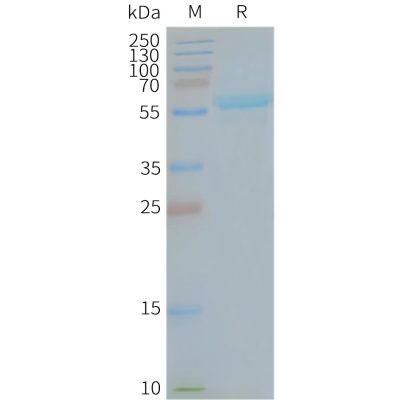 page-FLP100106 MFSD13A Fig.2 SDS PAGE 1