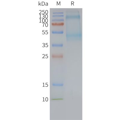 page-FLP100107 ADGRG2 Fig.2 SDS PAGE 1