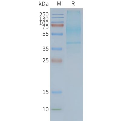 page-FLP100108 GPR20 Fig.2 SDS PAGE 1