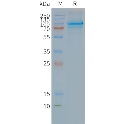 page-FLP100110 CLPTM1 Fig.2 SDS PAGE 1