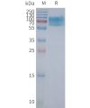 page-FLP100111 CHRM2 Fig.2 SDS PAGE 1