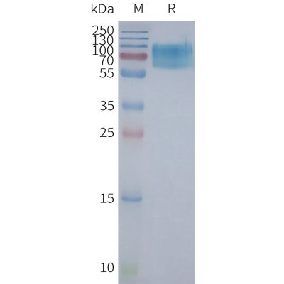 page-FLP100111 CHRM2 Fig.2 SDS PAGE 1