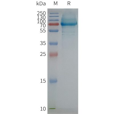 page-FLP100112 SCARB1 Fig.2 SDS PAGE 1