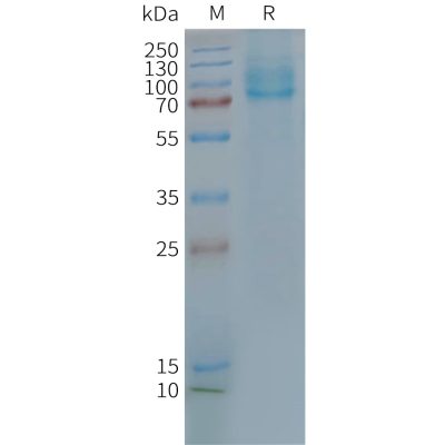 page-FLP100113 GLP2R Fig.2 SDS PAGE 1