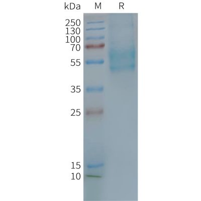 page-FLP100114 F2RL3 Fig.2 SDS PAGE 1