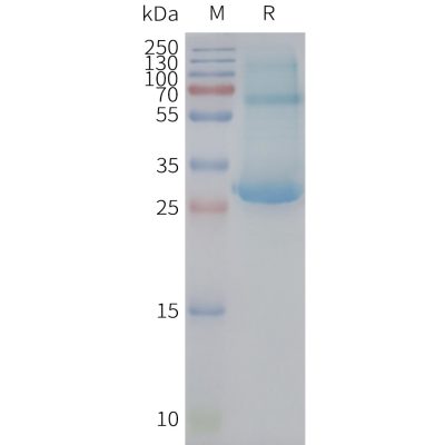 page-FLP100117 ADGRE5 Fig.2 SDS PAGE 1