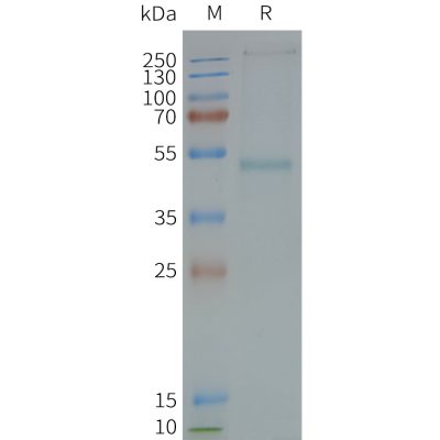 page-FLP100118 GRPR Fig.2 SDS PAGE 1