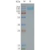 page-FLP100119 GRM7 Fig.2 SDS PAGE 1