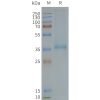 page-FLP100120 XCR1 Fig.2 SDS PAGE 1
