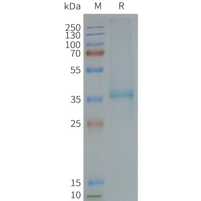 page-FLP100120 XCR1 Fig.2 SDS PAGE 1