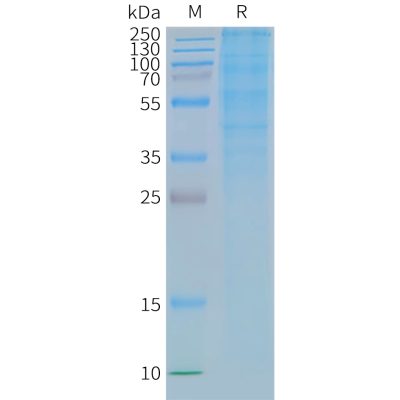 page-FLP100121 GLP1R Fig.2 SDS PAGE 1