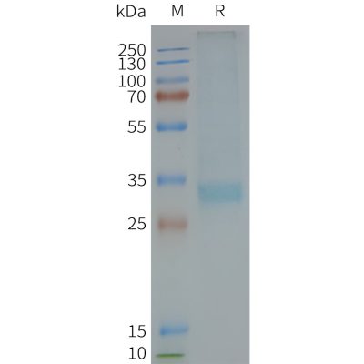 page-FLP100122 MC4R Fig.2 SDS PAGE 1