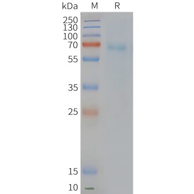 page-FLP100125 PTGDR2 Fig.2 SDS PAGE 1