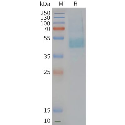 page-FLP100126 CMKLR1 Fig.2 SDS PAGE 1