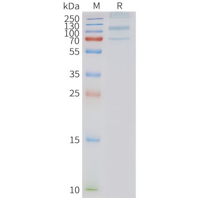 page-FLP100127 ADGRD1 Fig.2 SDS PAGE 1