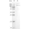 page-FLP100128 TRPV1 Fig.2 SDS PAGE 1