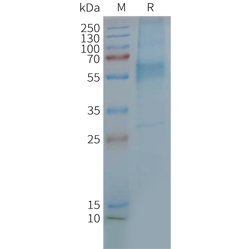 FLP100130-GIPR-Fig.2-SDS-PAGE-1.jpg