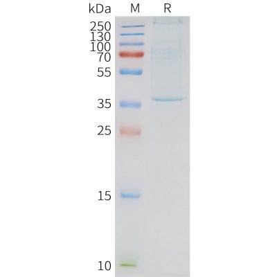 page-FLP100131 NTSR1 Fig.2 SDS PAGE 1