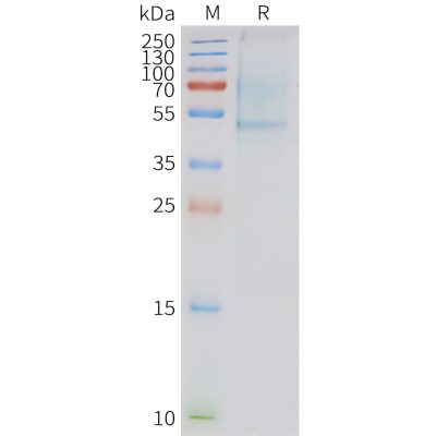 page-FLP100132 APLNR Fig.2 SDS PAGE 1