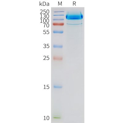 page-FLP100135 GRM2 Fig.2 SDS PAGE 1