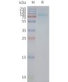 page-FLP100136 UTS2R Fig.2 SDS PAGE 1