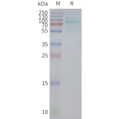 page-FLP100136 UTS2R Fig.2 SDS PAGE 1