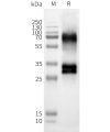 page-FLP100137 OR52D1 Fig.2 SDS PAGE 1