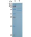 page-FLP100138 CB2 Fig.2 SDS PAGE 1